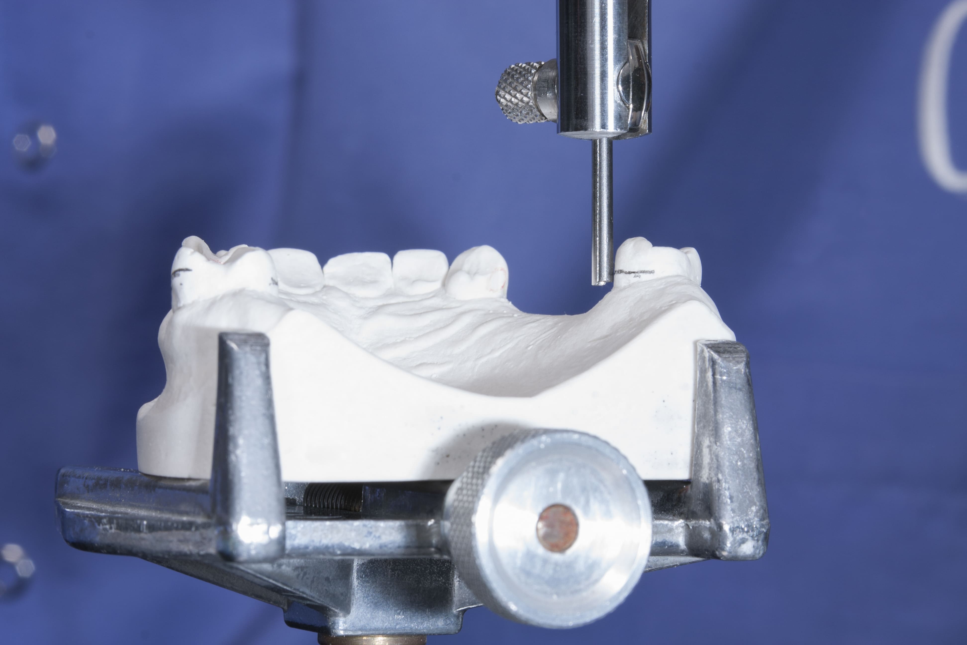 beneficios-de-la-rehabilitacion-oral